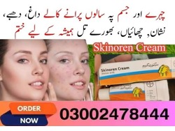 Skinoren Cream In Faisalabad-03002478444