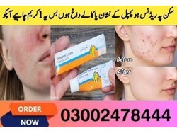 Skinoren Cream In Pakistan-03002478444