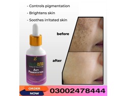 Anti Pigmentation Face Serum In Sargodha-03002478444